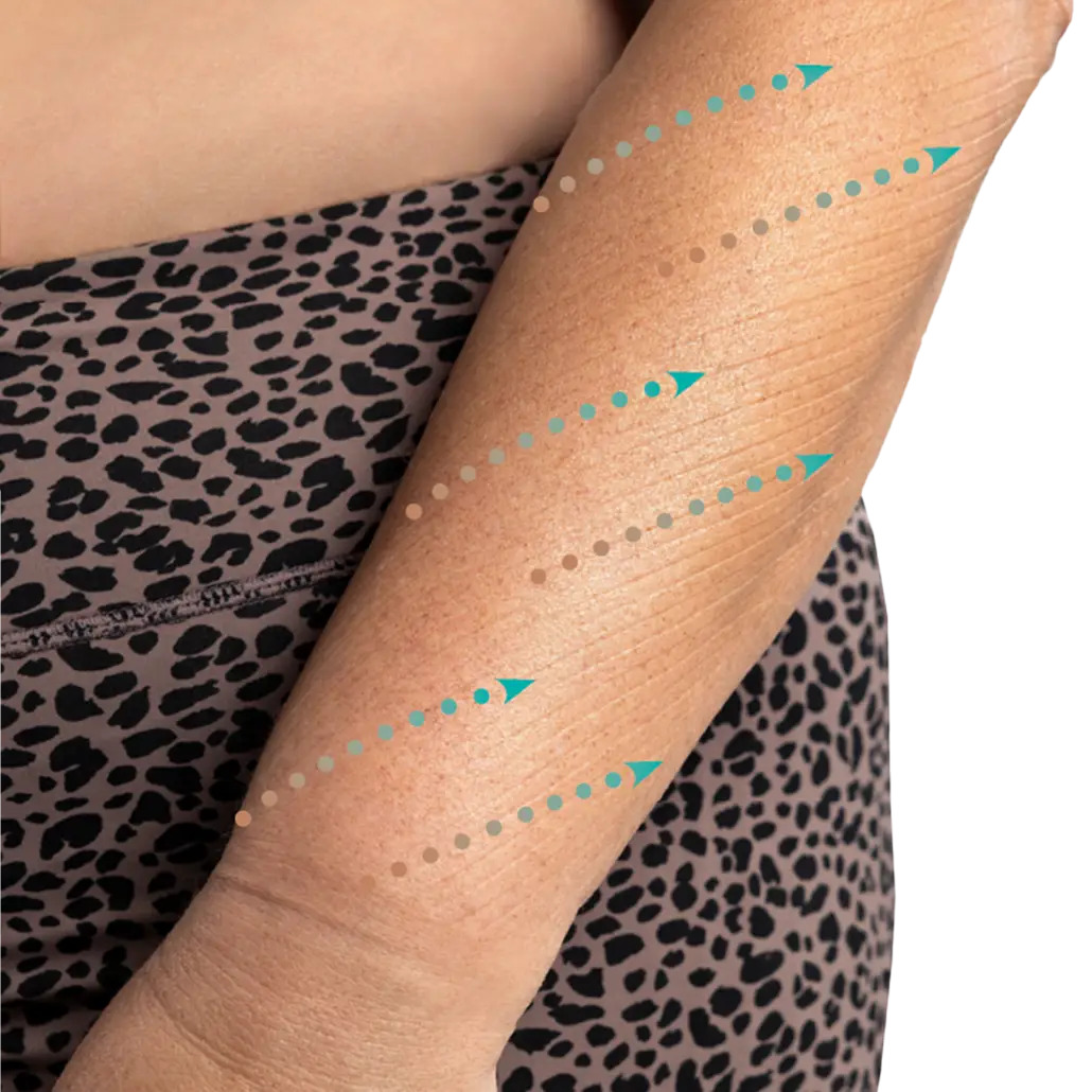 Abc Produktbild Move Armsleeve 10